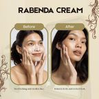 Rabenda Advance Whitening Cream - To Get Glowing Skin (150ml)