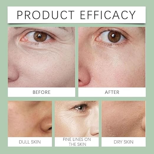 Rabenda | Skin Firming - Anti Aging & Skin Tightening Cream