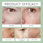 Rabenda | Skin Firming - Anti Aging & Skin Tightening Cream